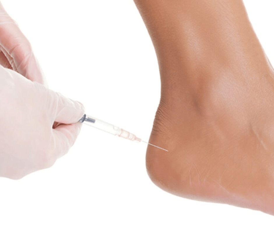 Avoiding Foot Surgery: How ClarixFlo® Injections Heal Stubborn Heel and Tendon Pain